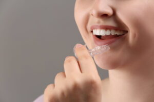 Are You a Good Candidate for Clear Aligners? Common Cases We Treat