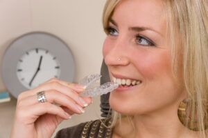 Invisalign FAQ's: What Patients Commonly Ask at Mantena Dental & Implant Center